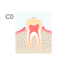 予防歯科/虫歯ＣＯ
