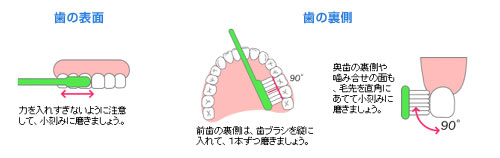 予防歯科/スクラッビング法