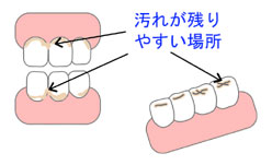 予防歯科/歯磨き法