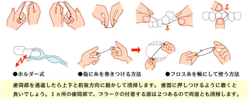 予防歯科/歯磨き法 デンタルフロス