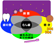 予防歯科/虫歯のできる条件