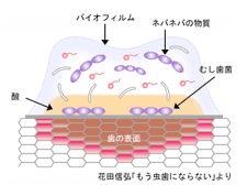 予防歯科/虫歯菌によるバイオフィルム