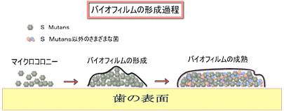 予防歯科/虫歯菌によるバイオフィルム形成過程