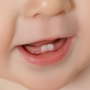 歯ぎしり　